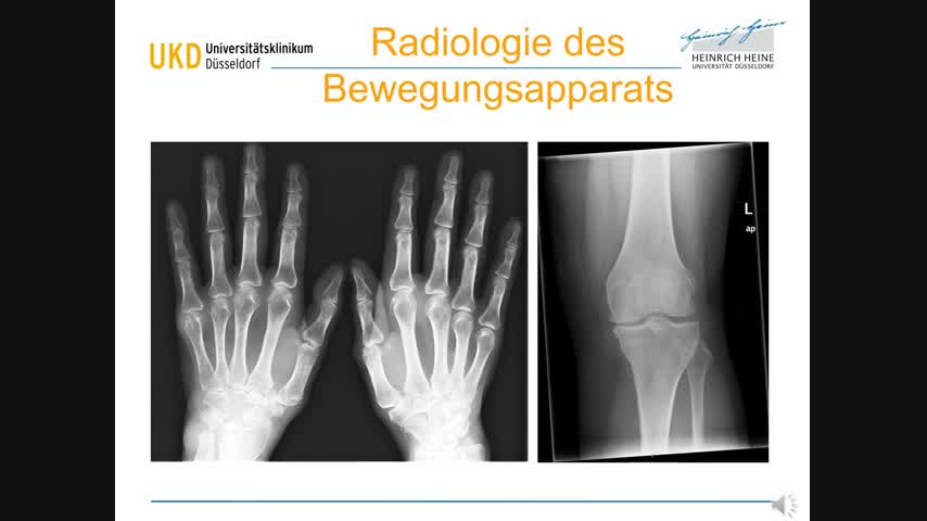 Vorlesung Radiologie Bewegungsapparat